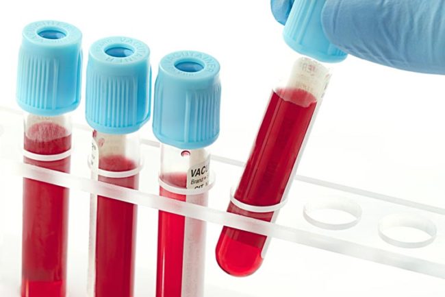 segnalazione_incidenti_dispositivi_in_vitro