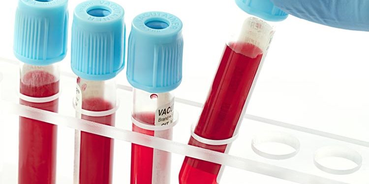 segnalazione_incidenti_dispositivi_in_vitro