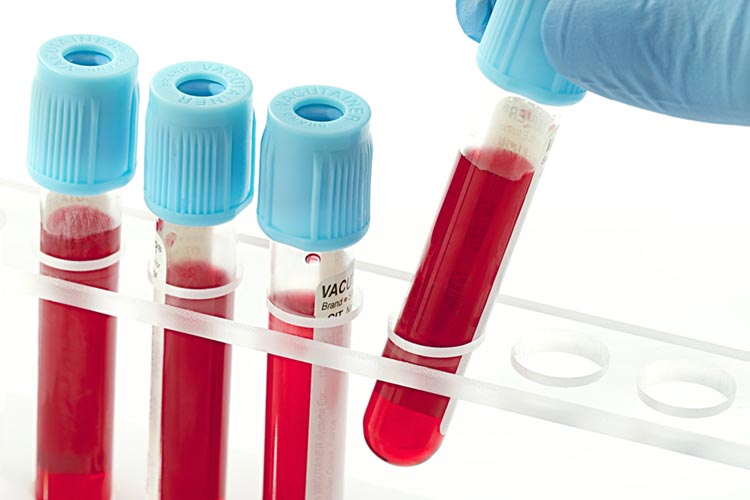 segnalazione_incidenti_dispositivi_in_vitro
