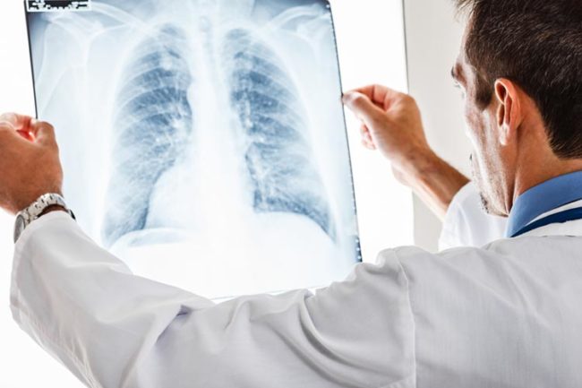 Allarme Malattie Occupazionali