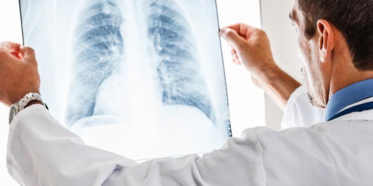 Allarme Malattie Occupazionali