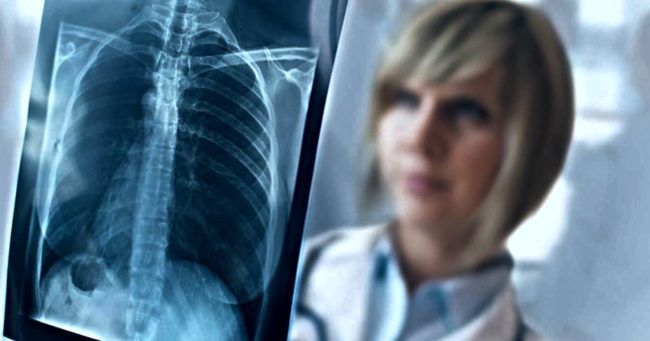 Benefici Assistenziali Mesotelioma non professionale